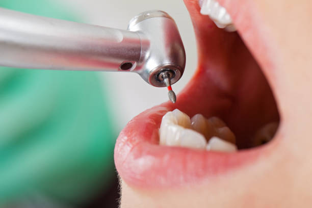 Best Emergency Denture Repair in Buckner, KY